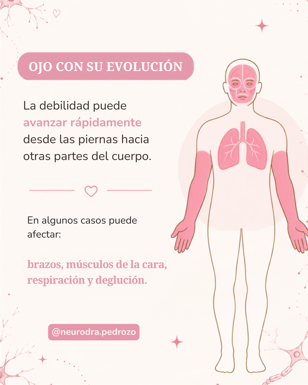 Imagen 3 - Reconoce las señales